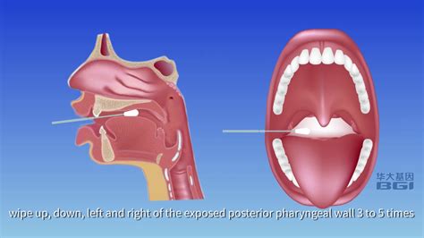 oropharyngeal swabs procedures